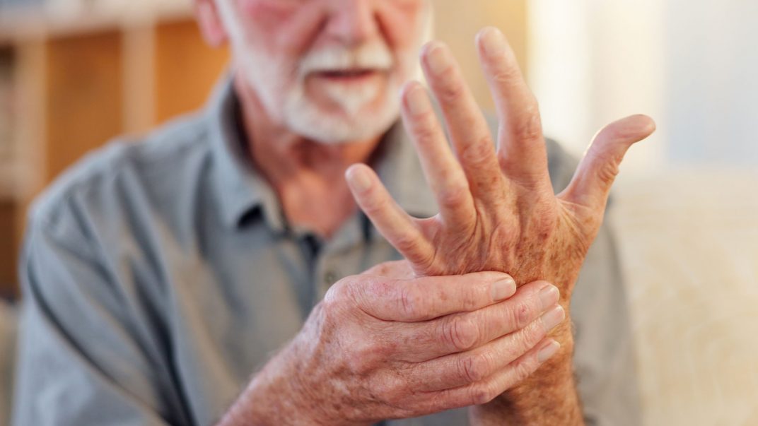 Arthritis Awareness Month: Understanding, managing, and supporting those affected 1 Arthritis